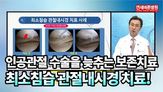 인공관절 수술을 늦추는 내 무릎 보존치료