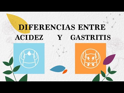 ¿Qué es la