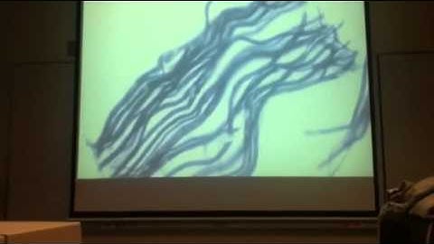 Microscope: Teased Axon Nerve Fiber