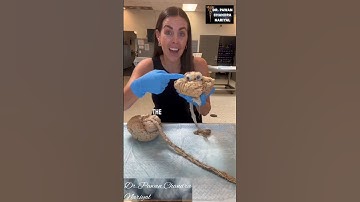 The Brain And Spinal Cord..... #shorts