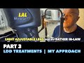 Ldd treatments for the light adjustable lens  my approach to light treatments for the lal