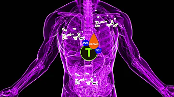Is nivolumab an immunotherapy?