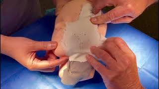 Download lagu Deep Plane Facelift vs Weekend (SMAS) Facelift Demonstration (Non-Graphic)