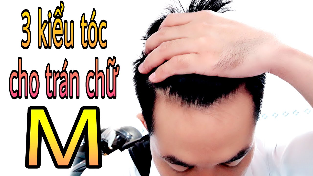 Điểm Danh Các Kiểu Tóc Phù Hợp Cho Bạn Nam Trán Cao