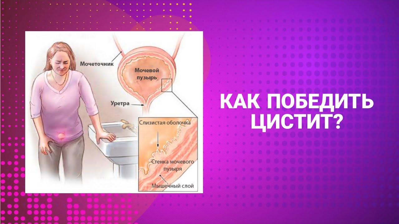 ЦИСТИТ. Как вылечить?#сибирскоездоровье #частоемочеиспускание# ...