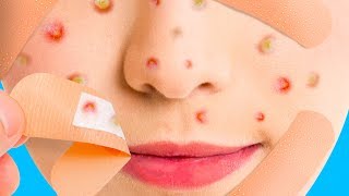 19 NATURAL RECIPES FOR BLACKHEADS AND CLEAN SKIN