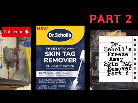 Dr. Scholl's Skin Tag Remover  Application and After 7 day Results 