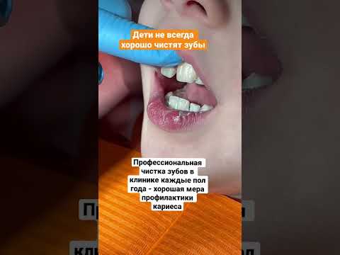 Чистка зубов детям