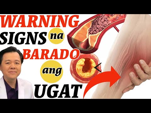 Video: Paano nakakaapekto ang puwersa sa paggalaw?