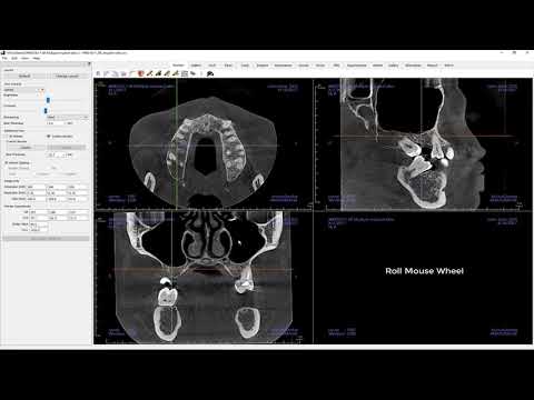 Invivo™ 6 Tutorial - Section View - Getting Started, Part 1