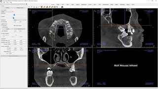 Invivo™ 6 Tutorial - Section View - Getting Started, Part 1