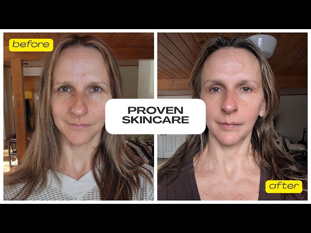 Proven Skincare Review 2025: Does This Personalized Routine Actually Work?