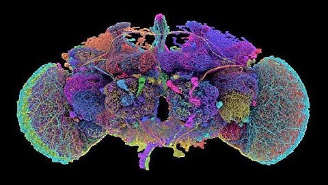 S01 Exploring the  Brain Complexity & the Dynamic Functional Connectivity EP:01