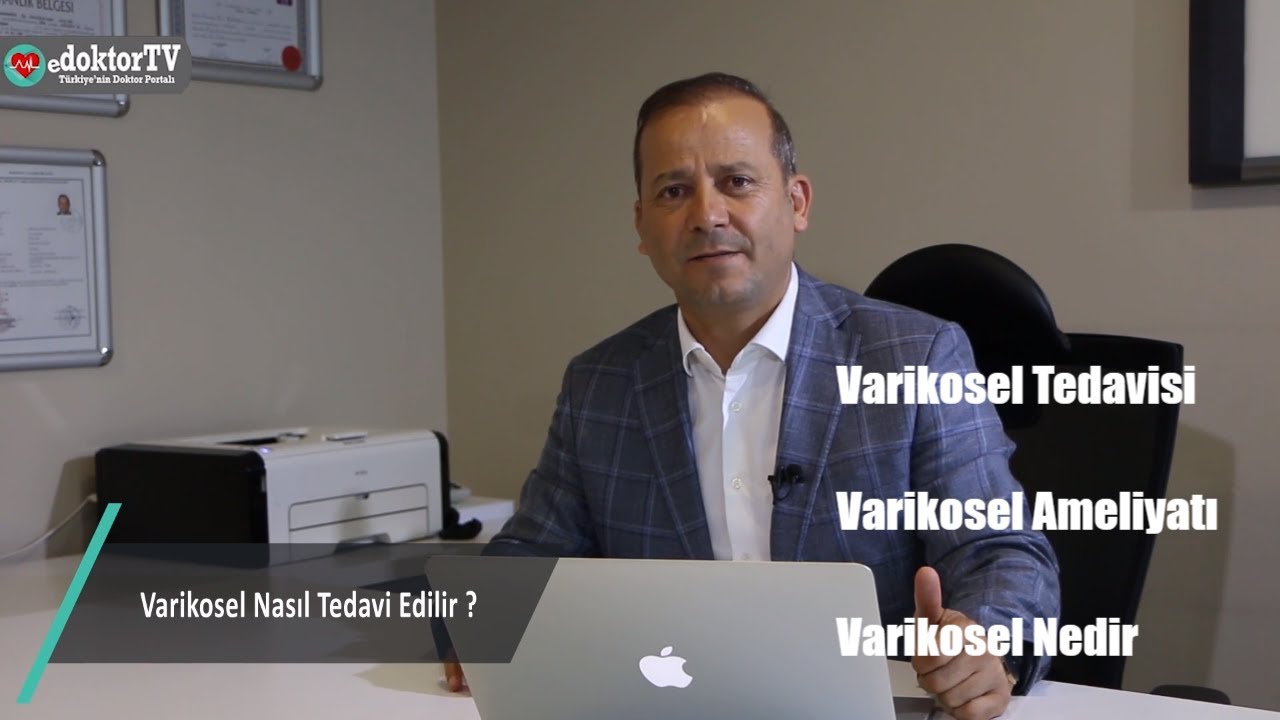 Belirtiler ve tedavi varikosel Belirtiler ve tedavi varikosel