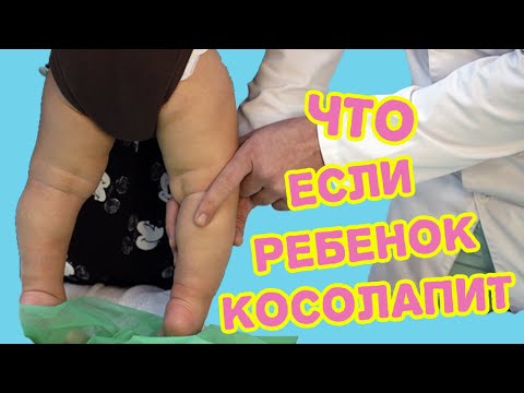 Видео: Кривоногие могут вызвать проблемы?