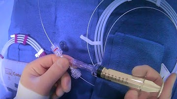 Microcatheter System