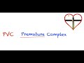 Premature Ventricular Contractions (PVC) Interpretation: Easy and Simple!