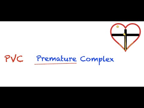 Premature Ventricular Contractions (PVC) Interpretation: Easy and Simple!