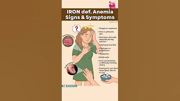 Don T Ignore These IRON DEFICIENCY Anemia Warning Signs 