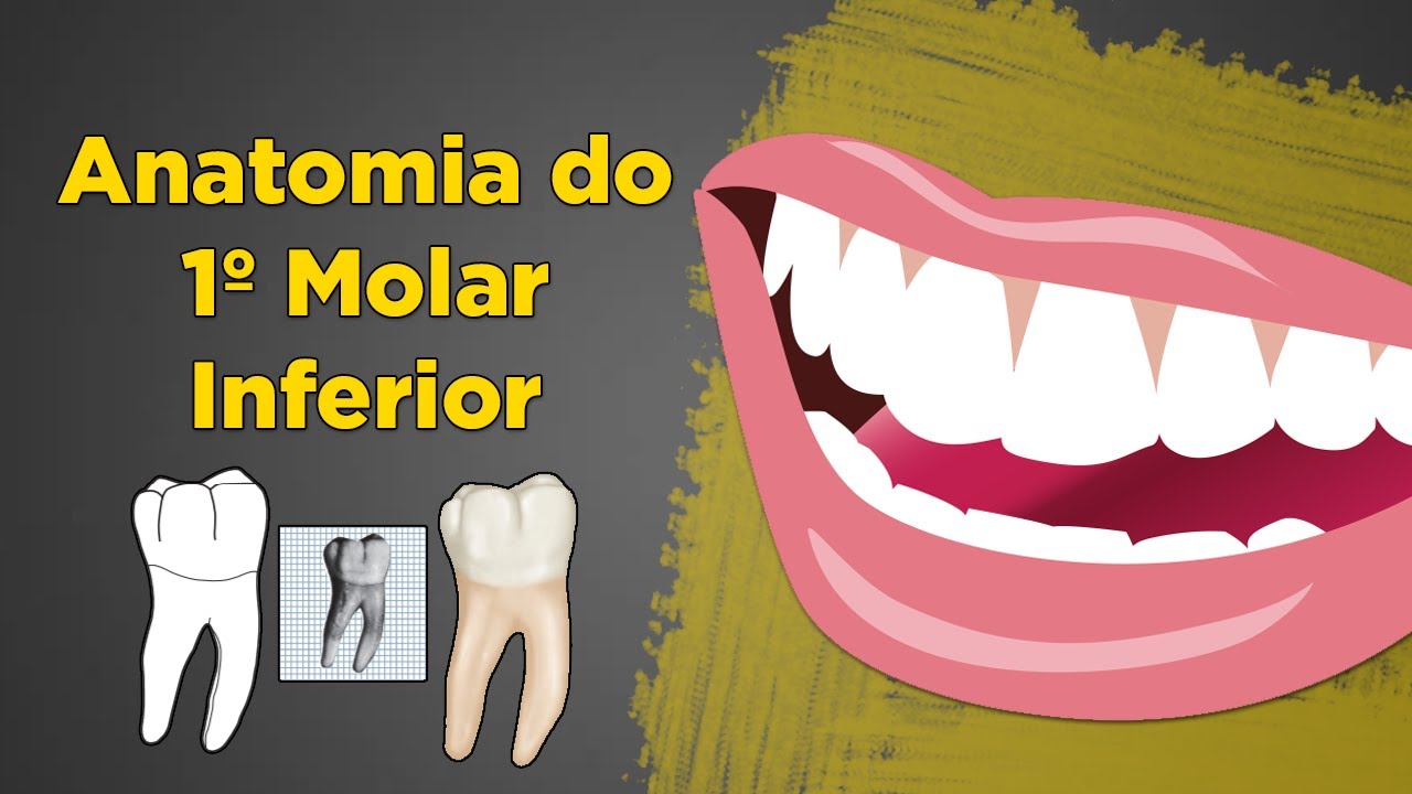Primeiro Molar Inferior Anatomia - Resumo de Anatomia Dental - Dente 36 e 46