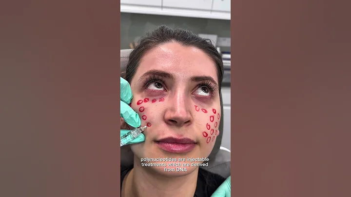 Why everyone’s talking about Polynucleotides in 2025!