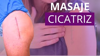 MASAJE y KINESIOTAPE de CICATRIZ para romper adherencias y aliviar dolor postcirugía | Fisiokorb