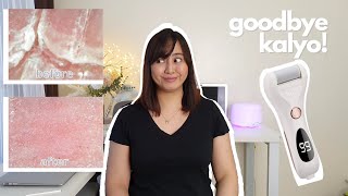 Automatic Callus Remover | Rechargeable Foot File Review | Tanggal Kalyo