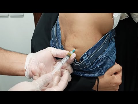 ازاى تدى حقنة عضل لاطفال عصبية جدا      