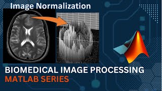 Image Normalization || MATLAB || Medical Image Processing screenshot 4