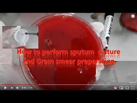 Sputum culture and Gram stain smear preparation