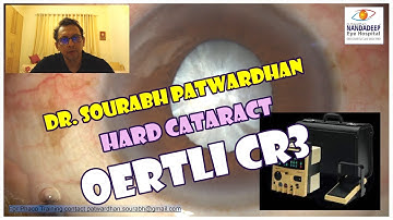 78 Oertli CR3 machine- first impressions Dr Sourabh Patwardhan Hard cataract small pupil