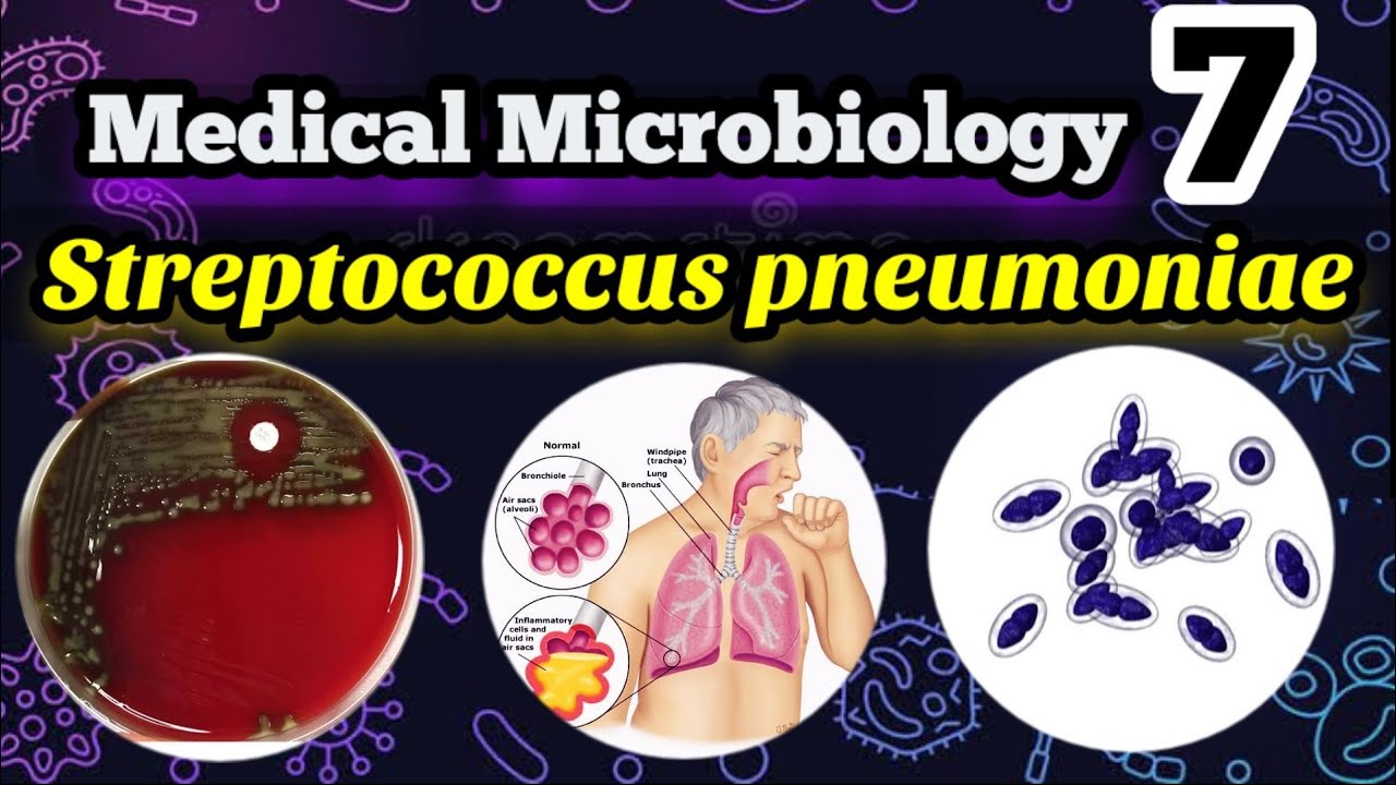 Streptococcus pneumoniae شرح بالعربي البكتيريا المسببه لإلتهاب  الرئوي والجيوب الأنفية والأذن الوسطي