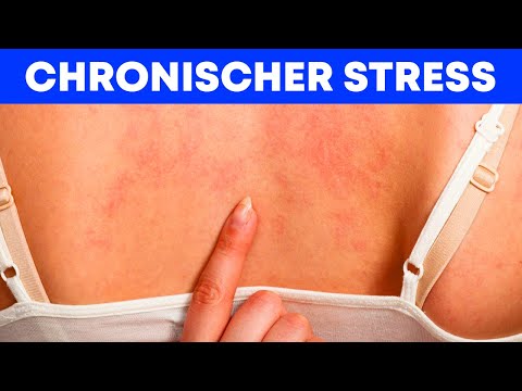 Video: Stresssymptome Bei Männern