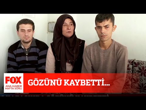 Gözünü kaybetti... 10