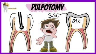 PEDIATRIC DENTISTRY | PULPOTOMY | Types, Indications, Procedure