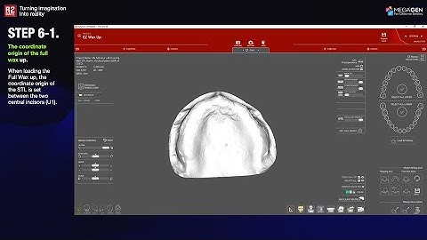 [EN] R2GATE Stand Alone Update: STEP6-1. The origin of the Full Wax-up library is set U1(L1) point.