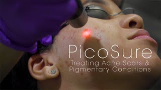 Laser PicoSure untuk Bekas Jerawat & Pigmentasi