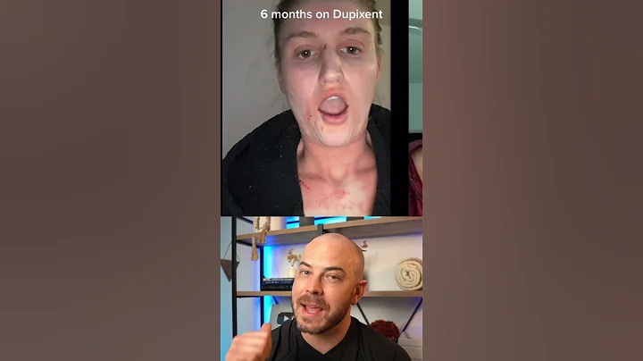 Doctor reacts to amazing eczema transformation! #dermreacts #doctorreacts #dupixent - DayDayNews