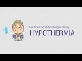 ECG changes in Hypothermia - What are the &#39;Osborn waves&#39; or &#39;J waves&#39;?
