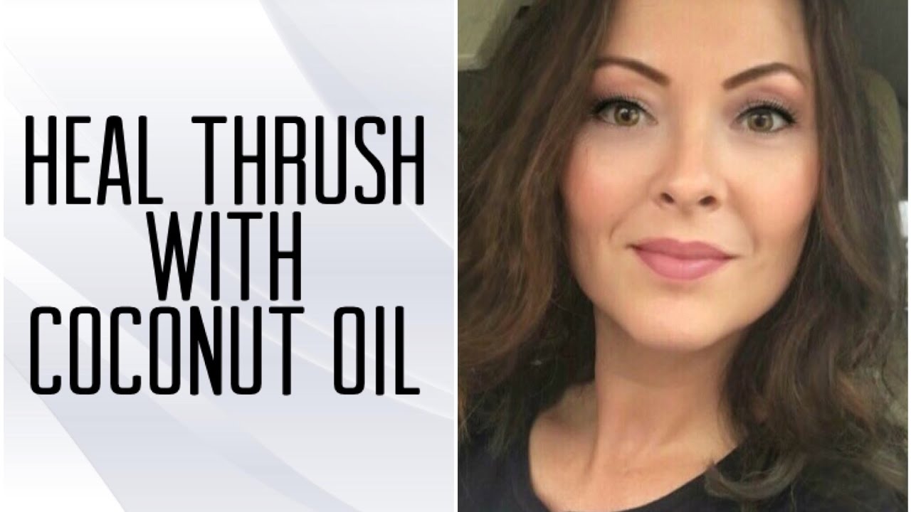 Heal Thrush Oral and Fungal Infections with Coconut Oil YouTube