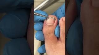 Dirty toenail trimming…… #pedicure  #toenails