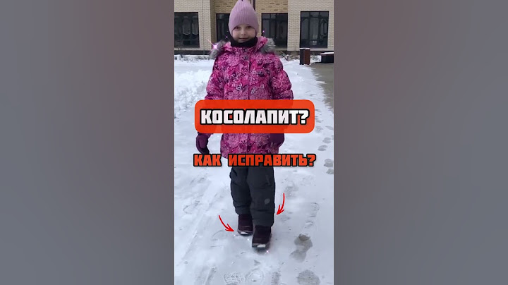 Косолапит?