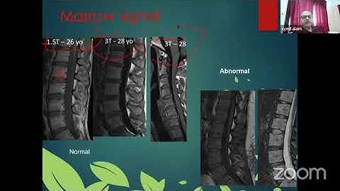 Spine MRI Made Easy