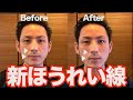 【初公開】ほうれい線に効く「上唇鼻翼挙筋リリース」【大分市 腰痛治療家 GENRYU ( 安部元隆 )】Reduce the laugh lines with GENRYU's METHOD