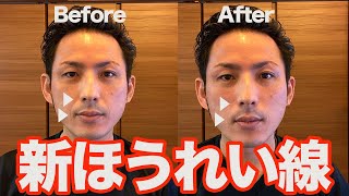 【初公開】ほうれい線に効く「上唇鼻翼挙筋リリース」【大分市 腰痛治療家 GENRYU ( 安部元隆 )】Reduce the laugh lines with GENRYU's METHOD