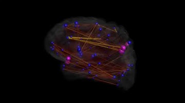 Connectome visualization