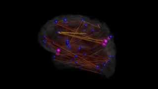 Connectome visualization