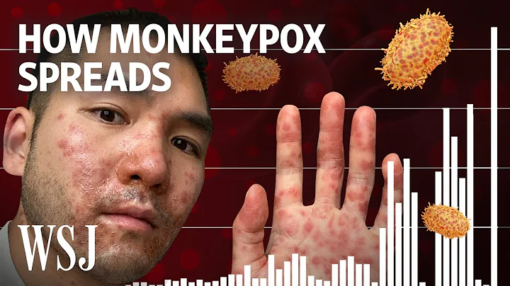 Why Monkeypox Is a Global Health Threat | WSJ - DayDayNews