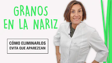 ¿Qué causa el acné en la nariz?