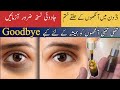 Remove Dark Circles in 3 Days | Eye Brightening Remedy | Husnology by Iqra 